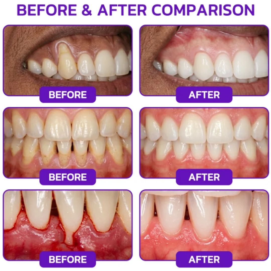 PerioCare™ | Bee Venom Toothpaste