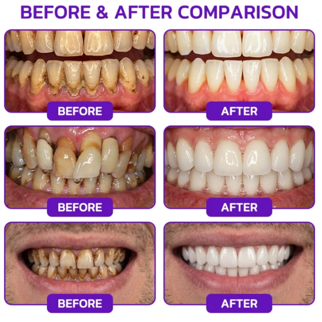 PerioCare™ | Bee Venom Toothpaste